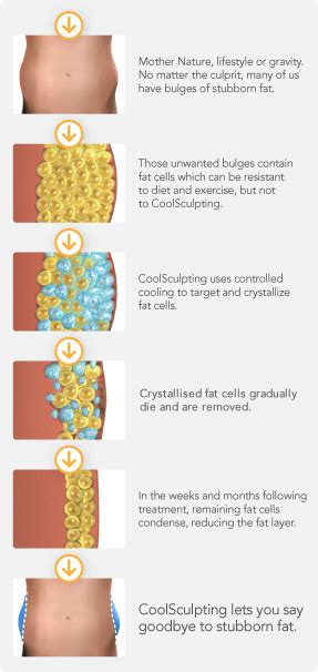 coolsculpting brisbane|coolsculpting adelaide.
